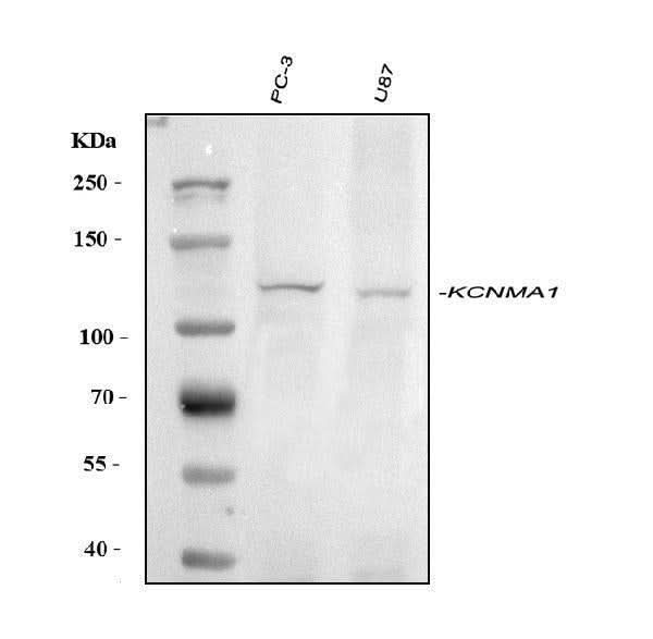 Anti-Maxi Potassium channel alpha/KCNMA1 Antibody Picoband® Boster Bio