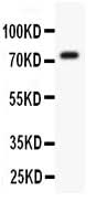 Anti-Kv4.3/KCND3 Antibody Picoband® Boster Bio