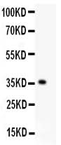 Anti-KLF6 Antibody Picoband® Boster Bio