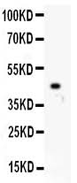 Anti-p73/TP73 Antibody Picoband® Boster Bio