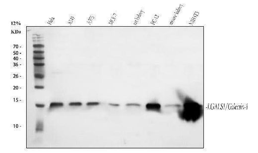 Anti-Galectin 1/LGALS1 Antibody Picoband® Boster Bio