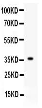 Anti-FGF1 Antibody Picoband® Boster Bio