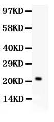 Anti-IL18 Antibody Picoband® Boster Bio