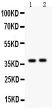 Anti-Calretinin/CALB2 Antibody Picoband® Boster Bio