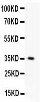 Anti-Fas Antibody Picoband® Boster Bio