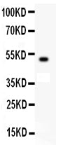 Anti-c-Kit Antibody Picoband® Boster Bio