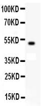 Anti-c-Kit Antibody Picoband® Boster Bio