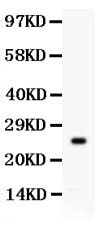 Anti-Kallikrein 4/KLK4 Antibody Picoband® Boster Bio