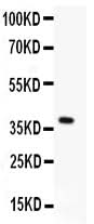 Anti-Menin/MEN1 Antibody Picoband® Boster Bio