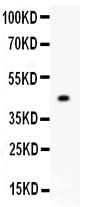 Anti-Mitofusin 2/MFN2 Antibody Picoband® Boster Bio
