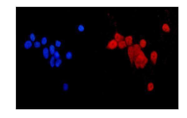 Anti-MGMT Antibody Picoband® Boster Bio