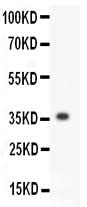 Anti-MMP3 Antibody Picoband® Boster Bio