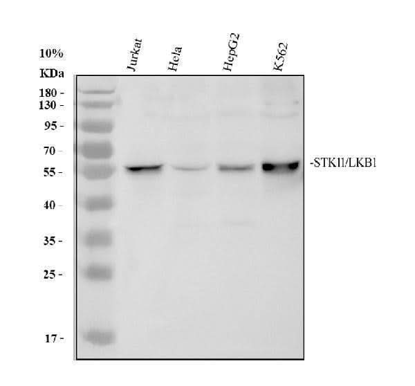 Anti-LKB1/STK11 Antibody Picoband® Boster Bio