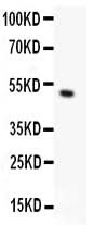Anti-TRPC5 Antibody Picoband® Boster Bio