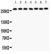Anti-LRRK2 Antibody Picoband® Boster Bio