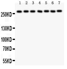 Anti-LRRK2 Antibody Picoband® Boster Bio