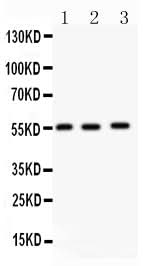 Anti-MMP14 Antibody Picoband® Boster Bio