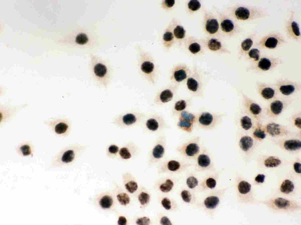 Anti-MSH2 Antibody Picoband® Boster Bio