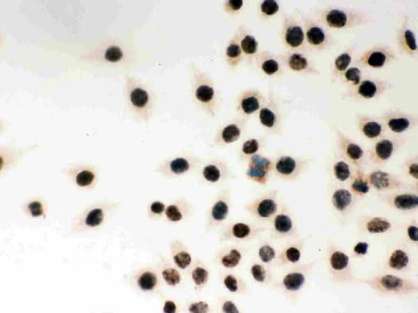 Anti-MSH2 Antibody Picoband® Boster Bio