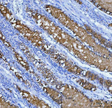 Anti-Mucin 5AC/MUC5AC Antibody Boster Bio