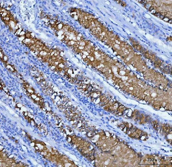 Anti-Mucin 5AC/MUC5AC Antibody Boster Bio
