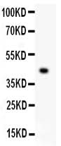 Anti-Mesothelin/MSLN Antibody Picoband® Boster Bio