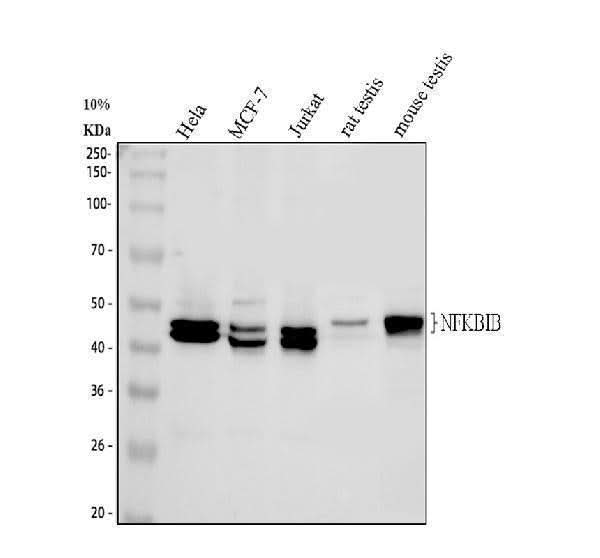 Anti-IKB beta/NFKBIB Antibody Picoband® Boster Bio