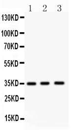 Anti-Nkx2.5/NKX2-5 Antibody Picoband® Boster Bio