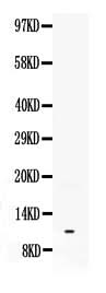 Anti-Neuropeptide Y/NPY Antibody Picoband® Boster Bio
