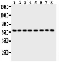 Anti-P2X2/P2RX2 Antibody Picoband® Boster Bio