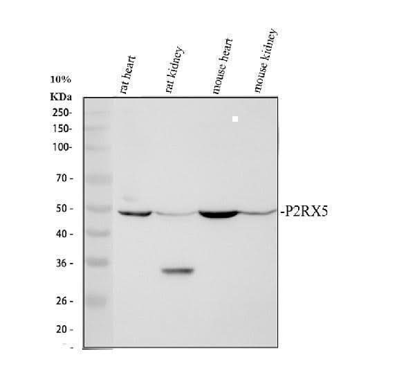Anti-P2X5/P2RX5 Antibody Picoband® Boster Bio