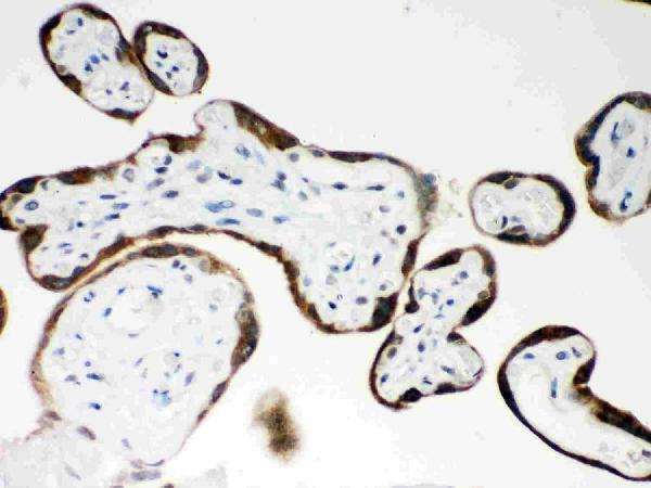 Anti-PAPP A/PAPPA Antibody Picoband® Boster Bio