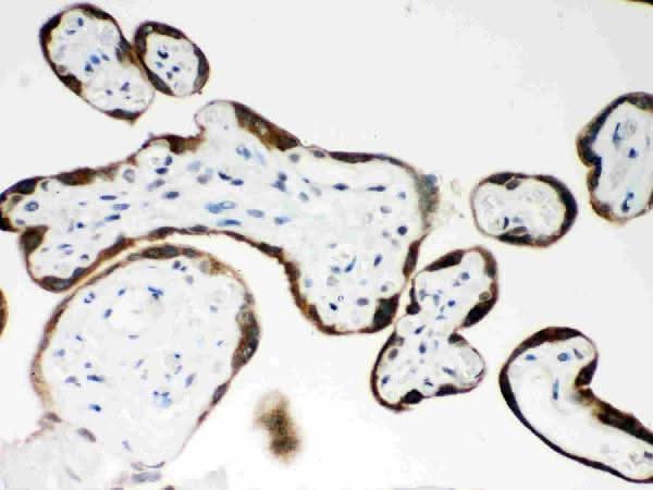 Anti-PAPP A/PAPPA Antibody Picoband® Boster Bio