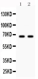 Anti-Parkin/PRKN Antibody Picoband® Boster Bio