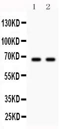 Anti-Parkin/PRKN Antibody Picoband® Boster Bio