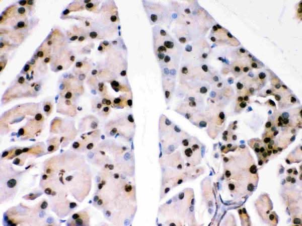 Anti-PARK7/DJ1 Antibody Picoband® Boster Bio