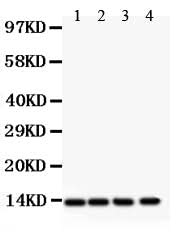 Anti-PDGF beta/PDGFB Antibody Picoband® Boster Bio