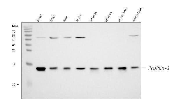 Anti-Profilin 1/PFN1 Antibody Picoband® Boster Bio