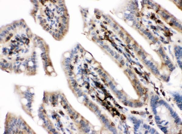 Anti-PKC alpha/PRKCA Antibody Picoband® Boster Bio