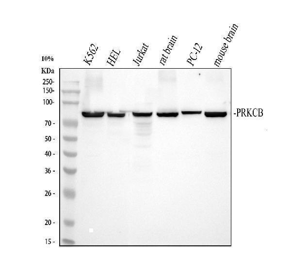 Anti-PKC beta 1/PRKCB Antibody Picoband® Boster Bio