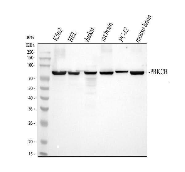 Anti-PKC beta 1/PRKCB Antibody Picoband® Boster Bio