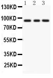 Anti-PKC epsilon/PRKCE Antibody Picoband® Boster Bio
