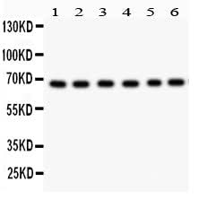 Anti-PKC iota/PRKCI Antibody Picoband® Boster Bio