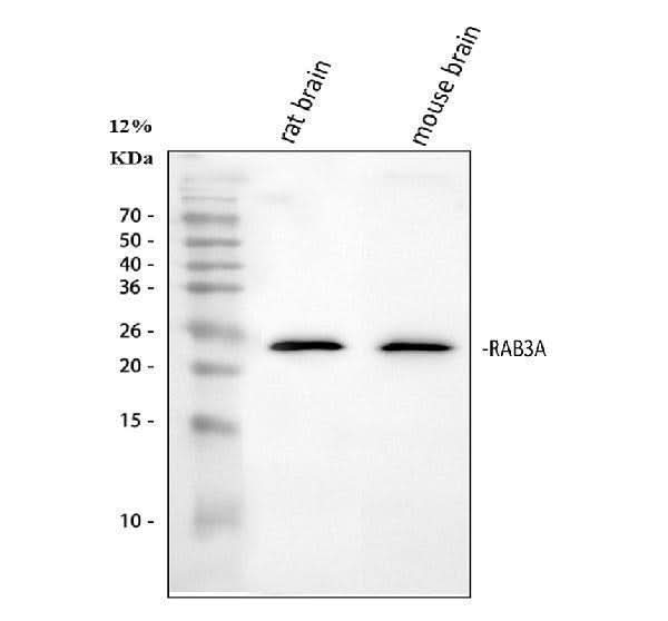 Anti-Rab3A Antibody Picoband® Boster Bio