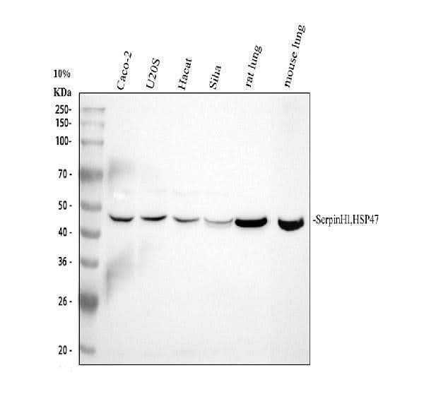 Anti-Hsp47/SERPINH1 Antibody Picoband® Boster Bio