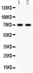 Anti-Sex Hormone Binding Globulin/SHBG Antibody Picoband® Boster Bio