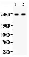 Anti-CaV1.3/CACNA1D Antibody Picoband® Boster Bio
