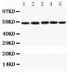 Anti-Caspase-8/CASP8 Antibody Picoband® Boster Bio