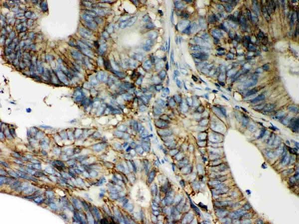 Anti-CD44 Antibody Picoband® Boster Bio