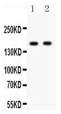 Anti-NMDAR2A/GRIN2A Antibody Picoband® Boster Bio